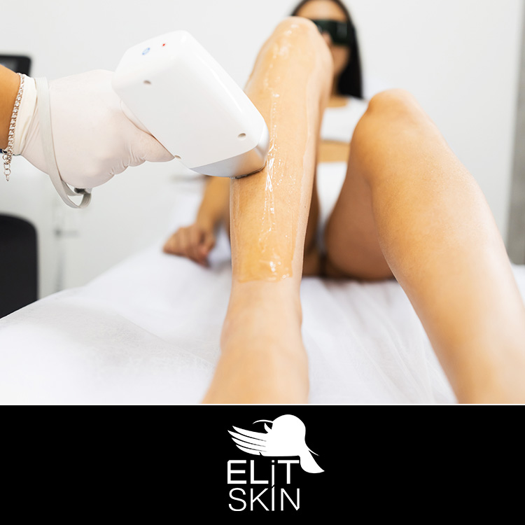 tartos-vegtelen-lezer-szortelenites-intim-veszprem