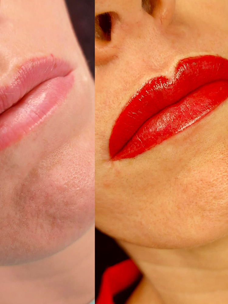 BeautyPen-sminktetovalas-elitstyle-veszprem-swisscolor-ajak